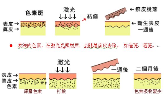 去色斑需要多少錢(qián)