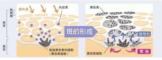 重慶激光祛斑效果好不好