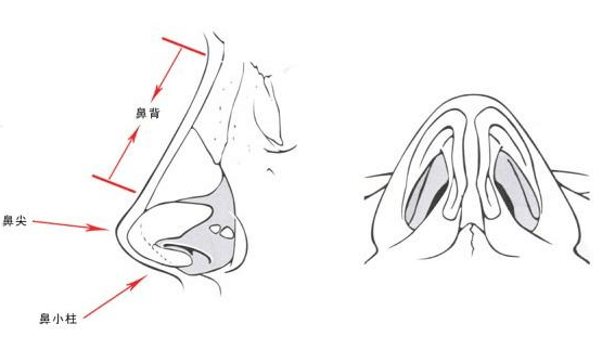 鼻子整形手術(shù)