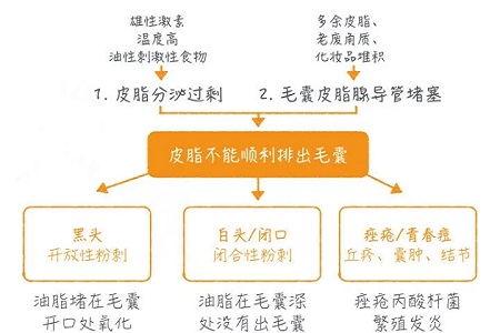 擠痘竟然被送進ICU！你的痘痘還好嗎？