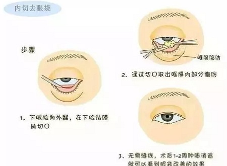 還把眼袋當(dāng)臥蠶？那就別怪小弟弟喊你阿姨了