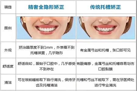 這種牙齒矯正方式，96%的人都會選擇！