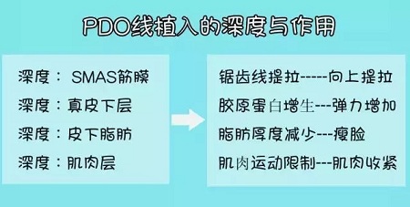 關(guān)于*雕，你想了解的都在這里！