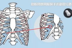 深圳隆鼻醫(yī)院做軟骨隆鼻多少錢，術后安全嗎